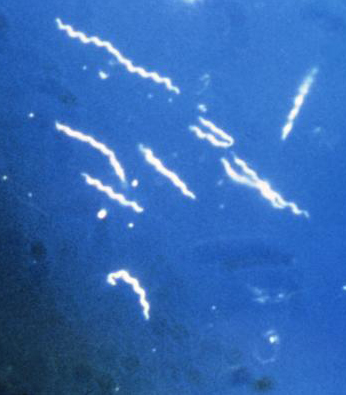 Borrelia Burgdorferi