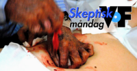 Psychic surgery