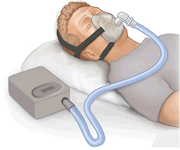 CPAP-apparat CPAP-apparat